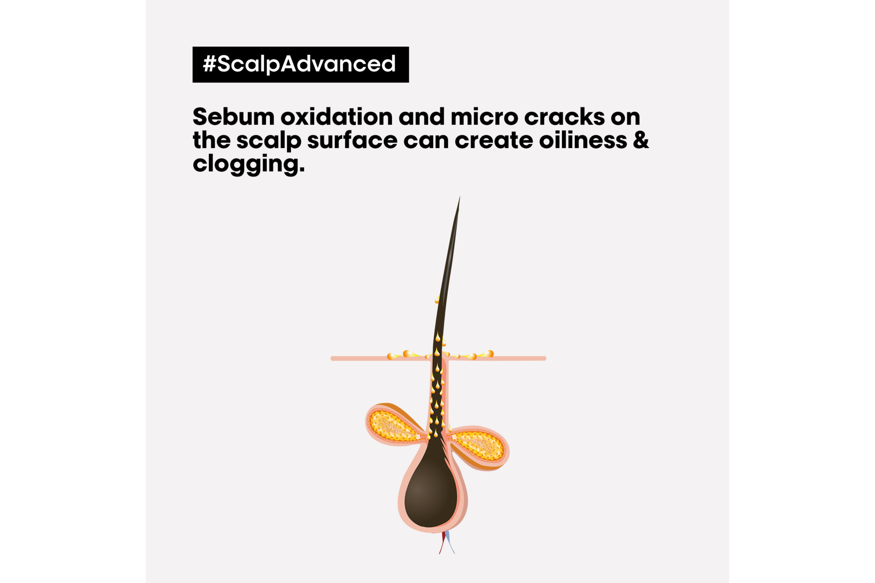 Scalp Advanced Anti Oiliness Shampoo 300mL