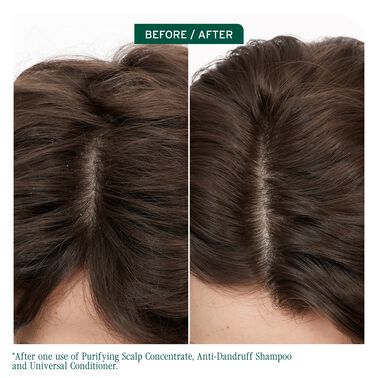 Scalp Sync Purifying Scalp Concentrate 200mL